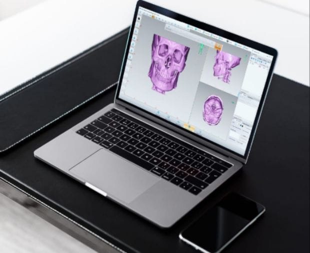 RS Mandaya Gunakan Teknologi Kesehatan 4.0 Berbasis 3D Print