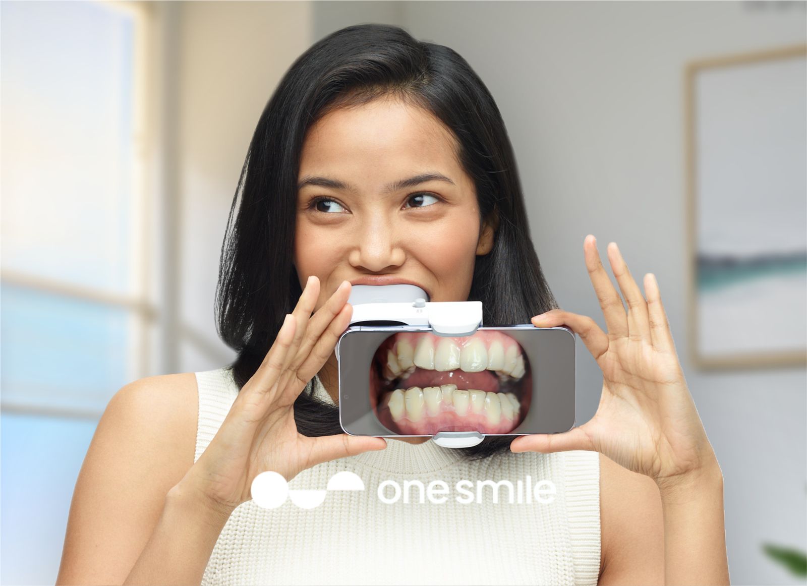 Merapikan Gigi dengan Teknologi Artificial Intelligence